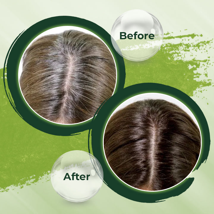 HerbCare™ Shampoo Bar | Krijg je kleur & levendigheid terug! Weg met grijze haren & haarverlies!