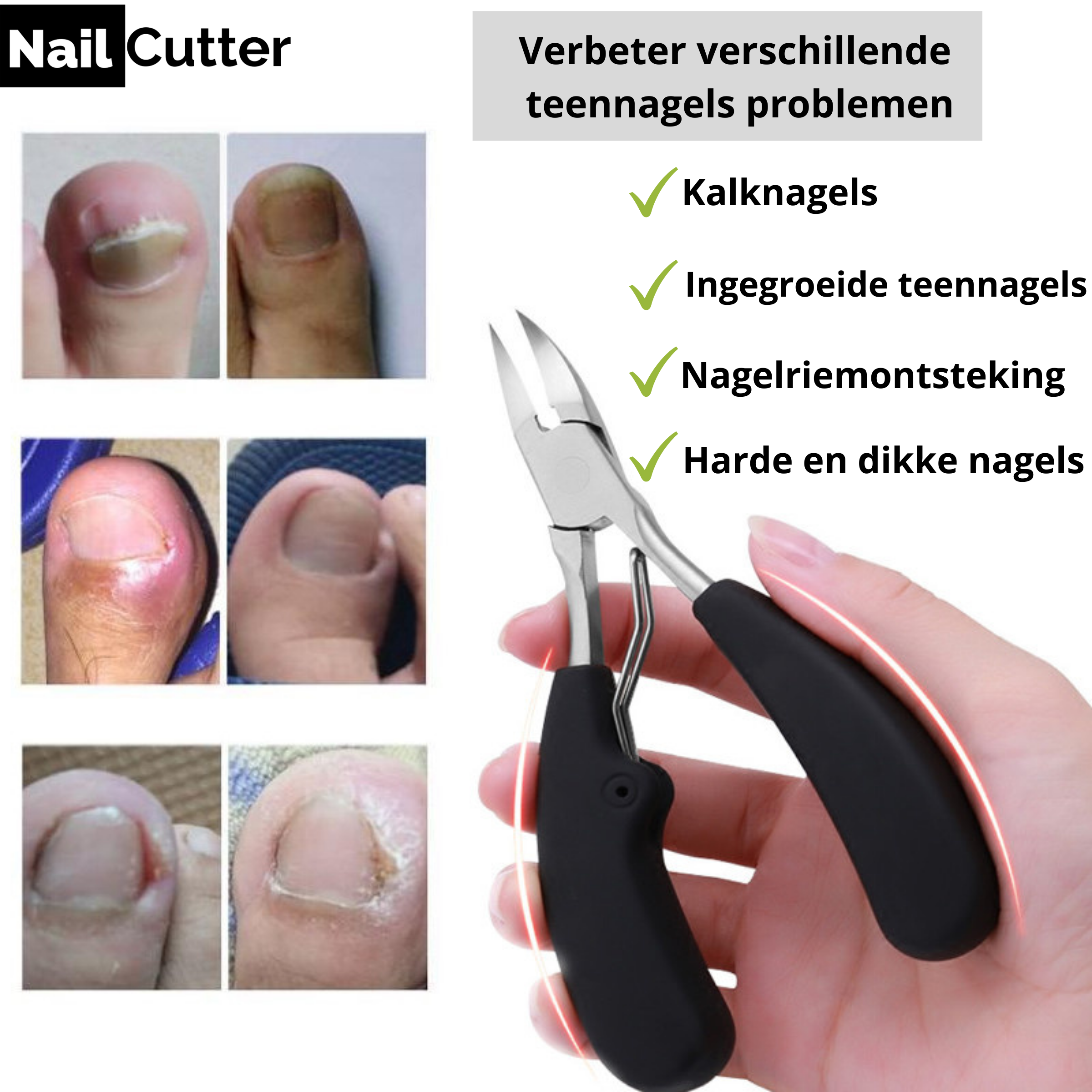 NailcutterPro™ De ultieme verzorgende nagelknipper!