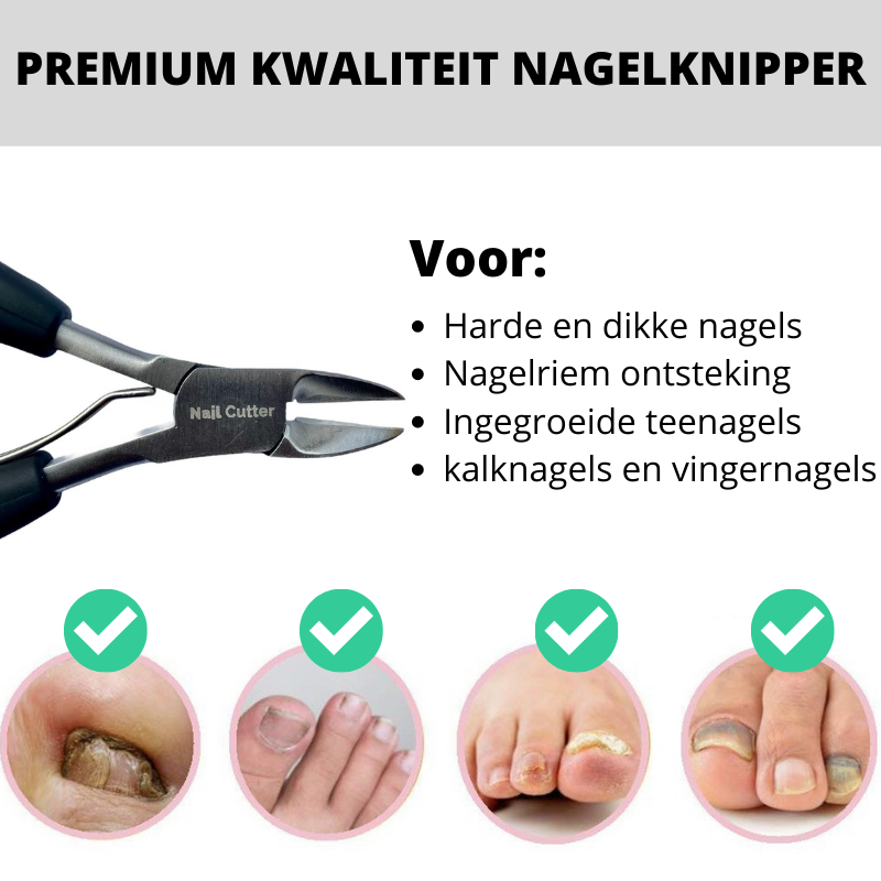 NailcutterPro™ De ultieme verzorgende nagelknipper!